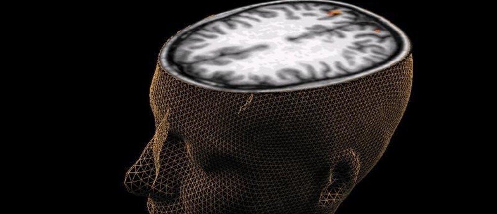 Will we tool up our own brains?