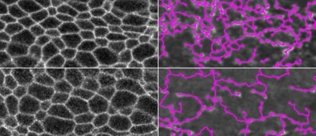 At top left are the cell membranes of a normal fruit fly embryo, and at right, overlaid in pink, is the myosin network that connects the cells. At bottom left are the cell membranes of an embryo in which myosin is degraded, and at bottom right, the myosin network is outlined in pink. In both cases, the embryos can still fold normally.