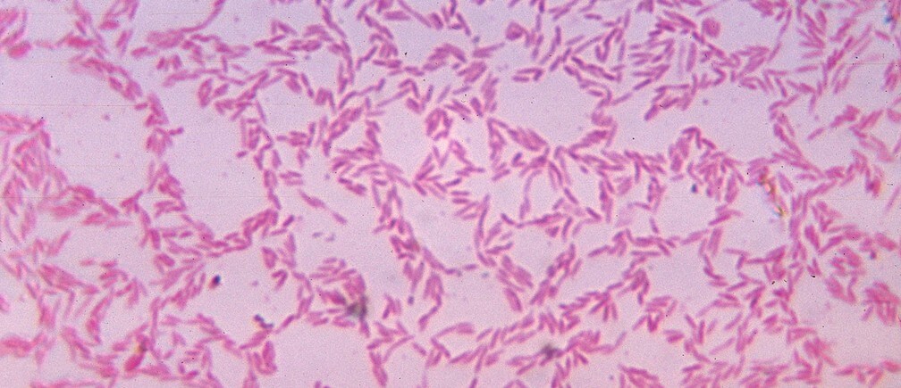How your gut bacteria affects your immune system