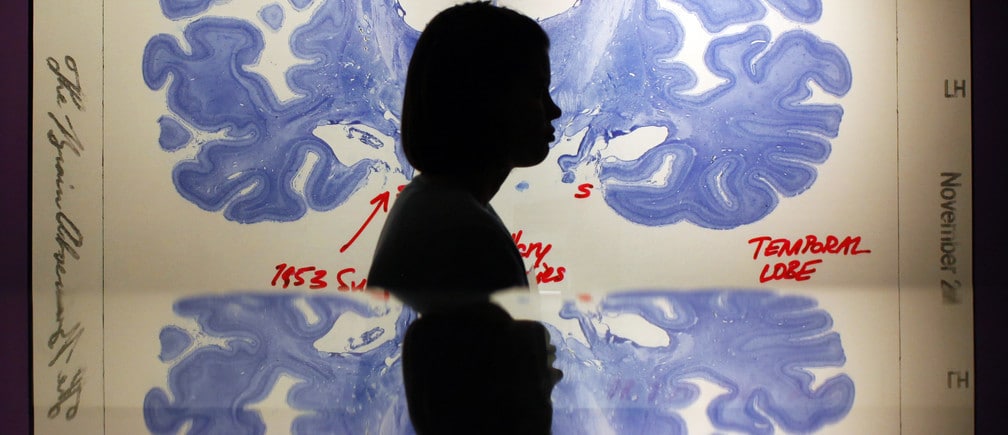 A woman walks past a display of a brain slice of patient “H.M.” at the press preview for the MIT 150 Exhibition at the MIT Museum, celebrating Massachusetts Institute of Technology’s 150 year anniversary, in Cambridge, Massachusetts January 7, 2011