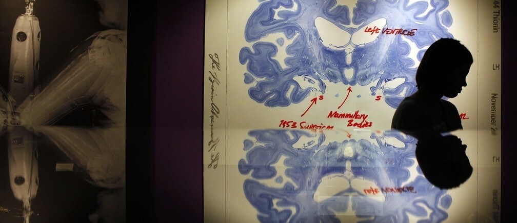 4 ways to improve your brain health
