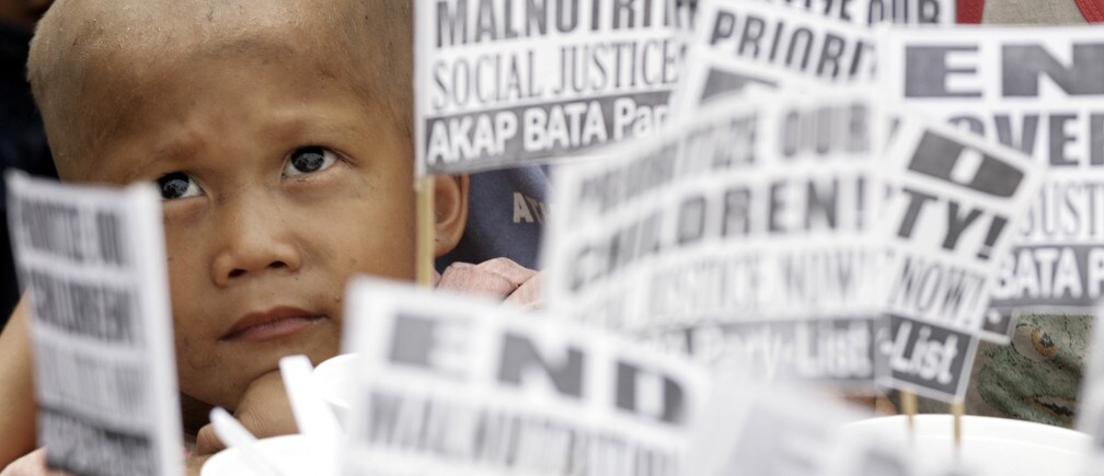 Is ending malnutrition unrealistic?