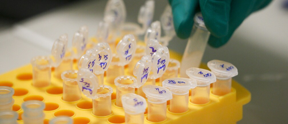The ethics of genome editing