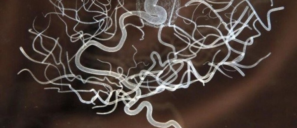 What speaking two languages does to the brain