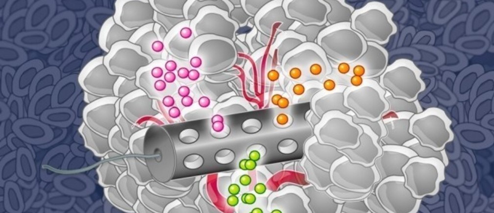 患者一人ひとりに最も効果的な薬を、どうすれば特定できるのでしょうか？