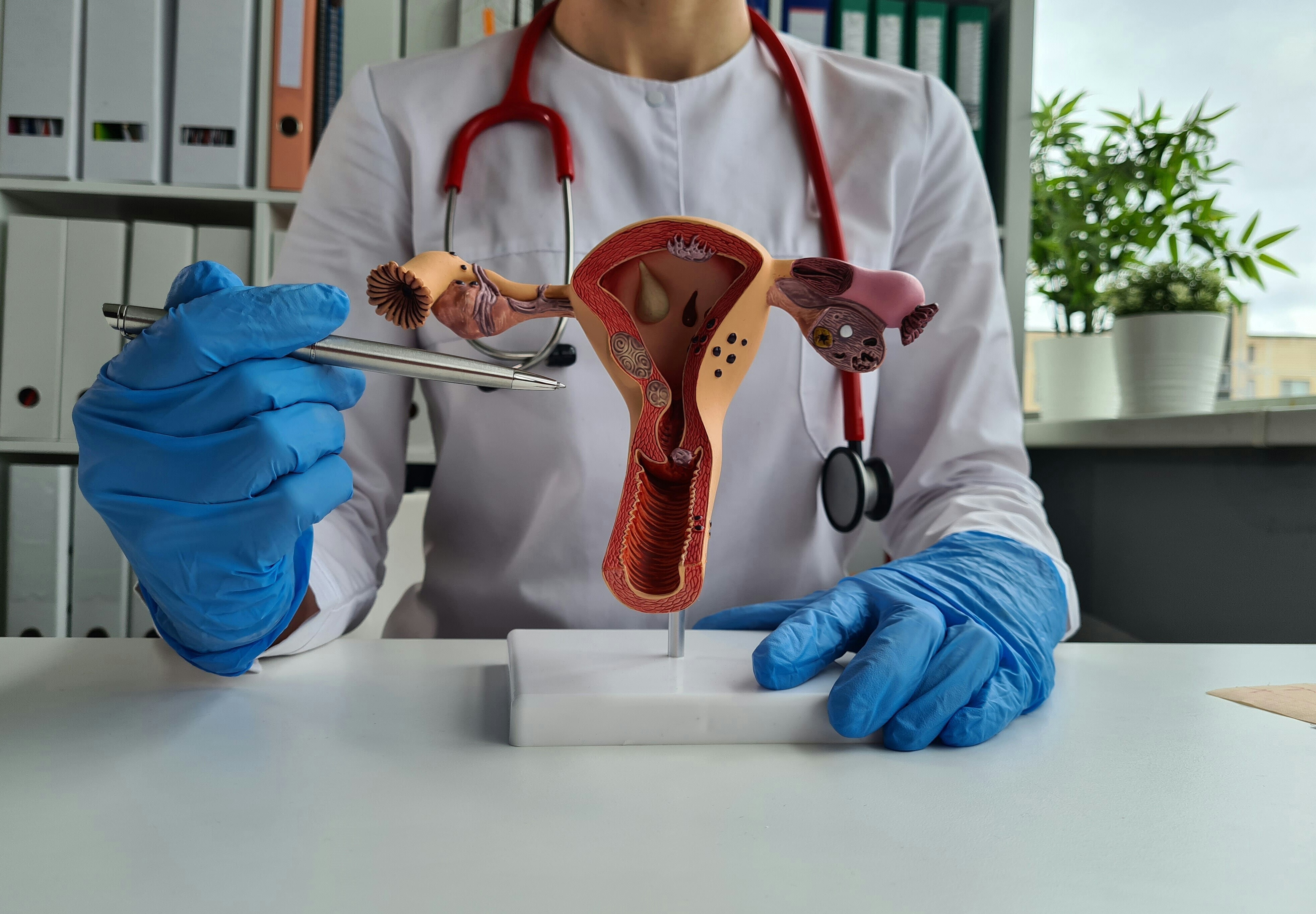 A doctor points to a model of a cervix, wearing blue gloves and holding a steel pen; she is wearing a white coat and has a stethoscope: Eliminating cervical cancer requires stronger health systems and community trust