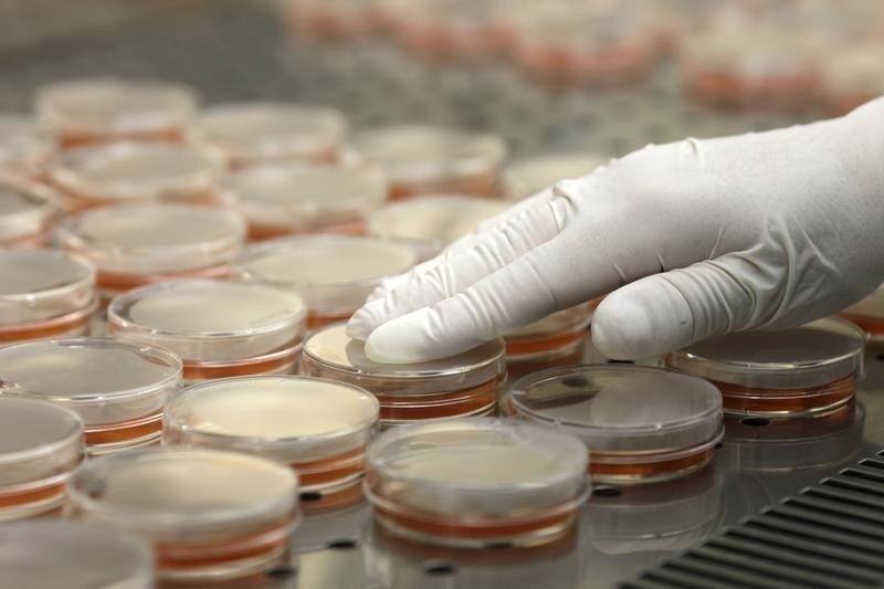 A specialist arranges petri dishes for Escherichia coli (E.coli) tests at the Institute of Food Safety, Animal Health and Environment in Riga June 9, 2011. More than 1,600 people have been infected by a toxic strain of E.coli bacteria that has killed at least 17 and may be the deadliest yet in human history. Latvian government officials on Thursday informed media of stringent monitoring and control over its food sources, and the country has yet to be hit with any E.coli related cases.