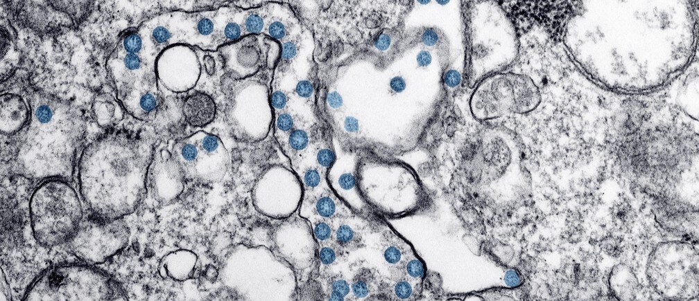 Un aislado del primer caso de COVID-19 en EE.UU., antes conocido como 2019-nCoV o nuevo coronavirus, se ve en una imagen de microscopía electrónica de transmisión obtenida de los Centros para el Control de Enfermedades (CDC).
