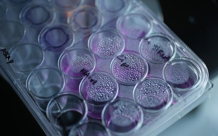 A tray containing cancer cells sits on an optical microscope in the Nanomedicine Lab at UCL's School of Pharmacy in London May 2, 2013. Is nanomedicine the next big thing? A growing number of top drug companies seem to think so. The ability to encapsulate potent drugs in nanoparticles measuring billionths of a metre in diameter is opening up new options for super-accurate drug delivery, increasing precision hits at the site of disease with, hopefully, fewer side effects. Photograph taken on May 2, 2013. REUTERS/Suzanne Plunkett (BRITAIN - Tags: BUSINESS HEALTH SOCIETY SCIENCE TECHNOLOGY)