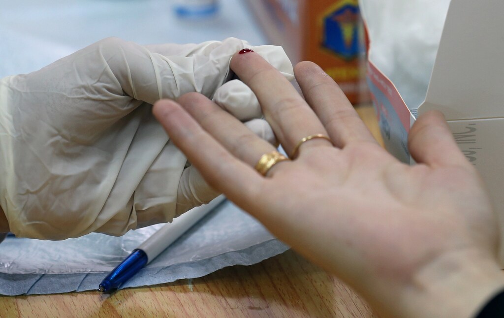 a picture of a doctor undertaking an Hepatitis C test