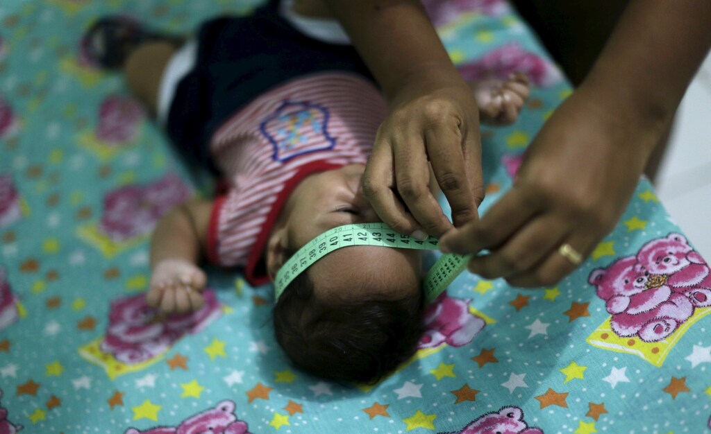 Guilherme Soares Amorim, 2 months, who was born with microcephaly, gets his head measured by his mother Germana Soares, at her house in Ipojuca, Brazil, February 1, 2016.