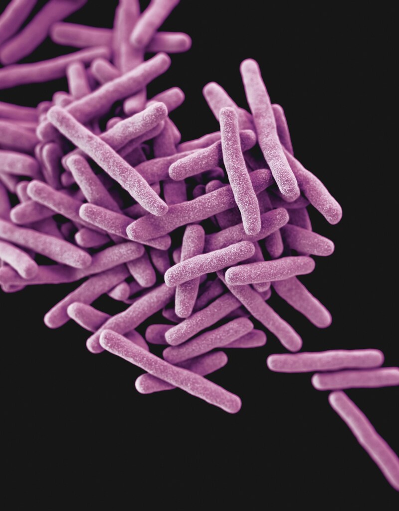 3D computer-generated image of Mycobacterium tuberculosis bacteria