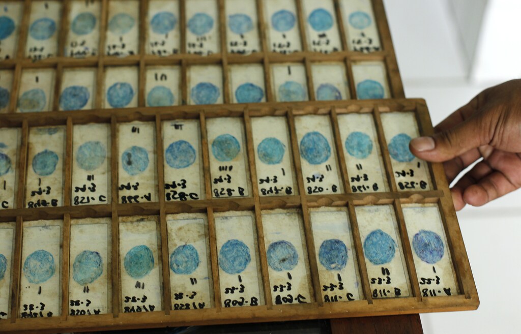 A volunteer holds sputum samples from tuberculosis patients at the Indonesian Union Against Tuberculosis clinic in Jakarta, April 4, 2011. Tuberculosis remains a major global public health problem, with 9.4 million new cases and more than 1.7 million deaths recorded in 2009. Indonesia has the fifth highest tuberculosis rate in the world after India, China, South Africa, and Nigeria based on 2009 World Health Organization (WHO) data. REUTERS/Beawiharta (INDONESIA - Tags: HEALTH) - GM1E74419PF01