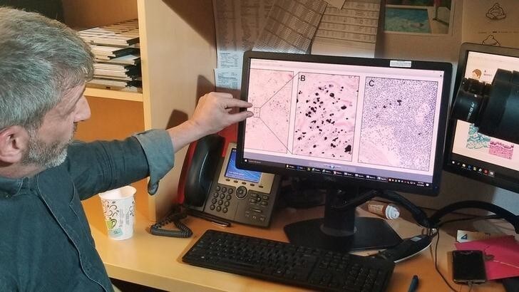 Neil Theise, MD, Pathologist at New York University School of Medicine and co-author of study by group of scientists who discovered interstitium, a new organ within the human body, looks at medical slides in New York City, U.S. March 27, 2018. Picture taken March 27, 2018. REUTERS/Elly Park