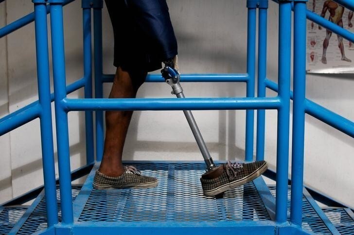 An amputee who had lost a leg during the 2010 earthquake undergo rehabilitative therapy at a center run by Handicap International in Port-au-Prince January 4, 2012. January 12 marks the second year anniversary of the devastating earthquake that killed more than 200,000 people and injured many.