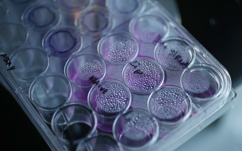 A tray containing cancer cells sits on an optical microscope in the Nanomedicine Lab at UCL's School of Pharmacy in London May 2, 2013. Is nanomedicine the next big thing? A growing number of top drug companies seem to think so. The ability to encapsulate potent drugs in nanoparticles measuring billionths of a metre in diameter is opening up new options for super-accurate drug delivery, increasing precision hits at the site of disease with, hopefully, fewer side effects. Photograph taken on May 2, 2013. REUTERS/Suzanne Plunkett (BRITAIN - Tags: BUSINESS HEALTH SOCIETY SCIENCE TECHNOLOGY) - LM1E9530RDY01