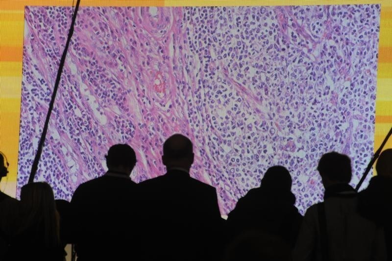 Cancer cells are seen on a large screen connected to a microscope at the CeBit computer fair in Hanover, March, 6, 2012. The biggest fair of its kind will run to March 10, 2012. REUTERS/Fabian Bimmer (GERMANY - Tags: BUSINESS TELECOMS SCIENCE TECHNOLOGY HEALTH) - BM2E83612TE01