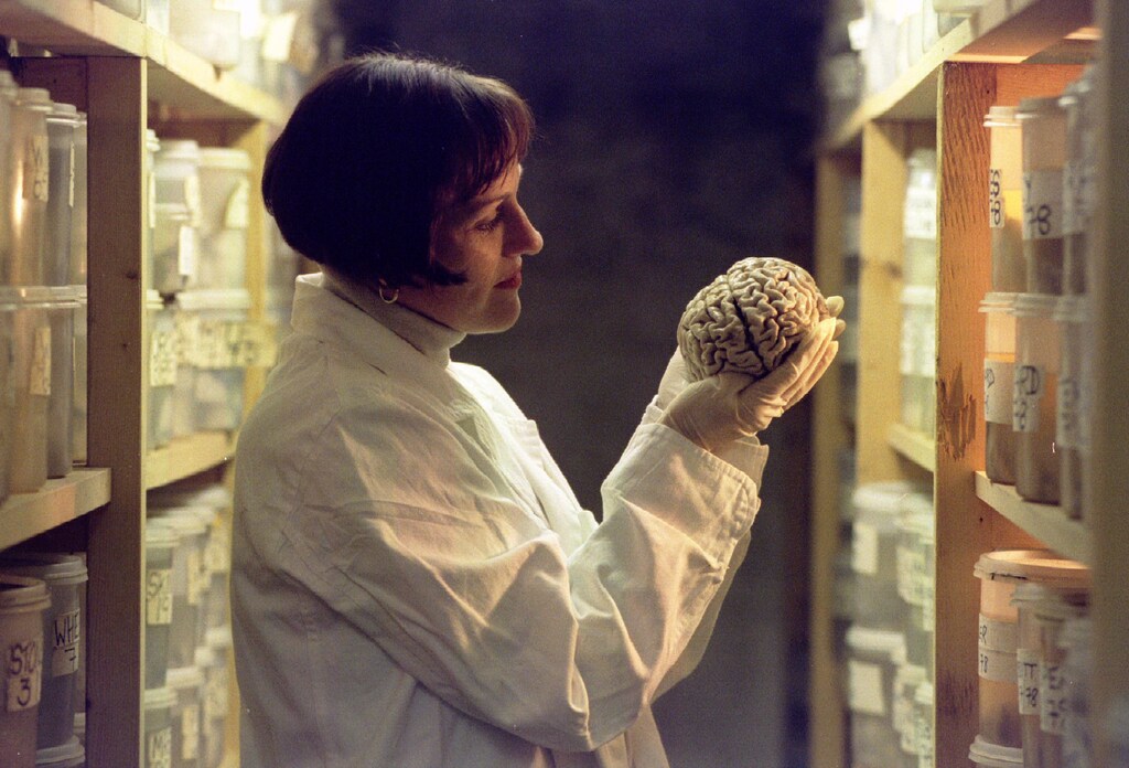 A laboratory worker holds a human brain, one from an archive of 8,000 stored in a World War II air raid shelter at Wickford, Essex. The Corsellis Collection of human brains and brain tissue, named after founder Professor Nick Corsellis, is being opened up to scientists and academics - PBEAHUMZYDH