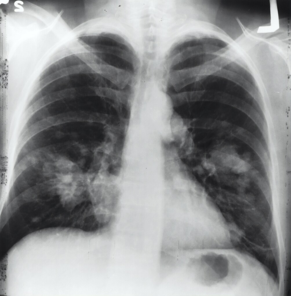 More than half a million children under five died in 2016 from respiratory infections caused by ambient and household air pollution, the WHO estimates.