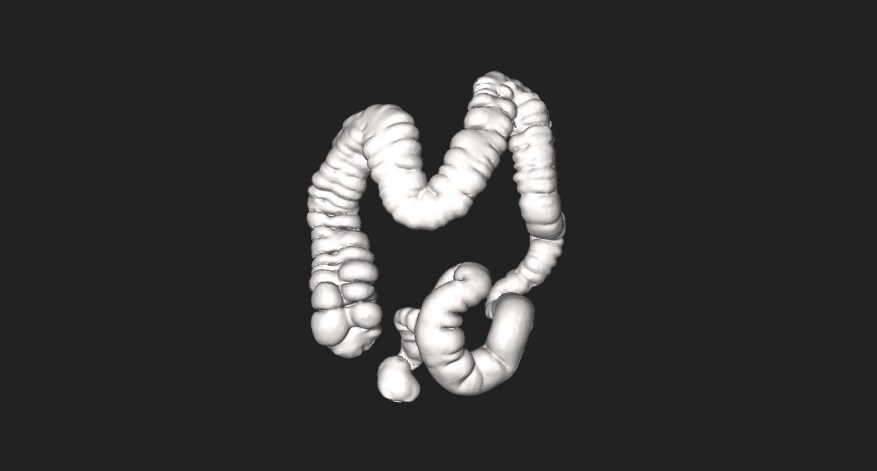 gut colon intestine Health virus bacteria medical medicine drugs vaccines vaccinations inoculations technology medicinal biotechnology biotech biology chemistry physics microscope research influenza flu cold common cold bug risk