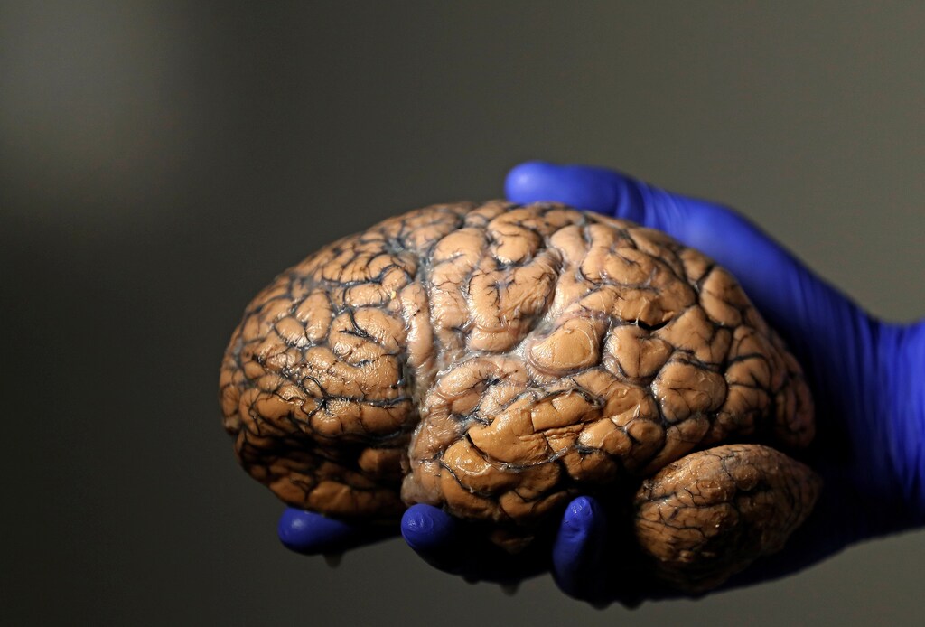 Belgian researcher Jeroen Schuermans holds a human brain, part of a collection of more than 3,000 brains that could provide insight into psychiatric diseases, at the psychiatric hospital in Duffel, Belgium, July 19, 2017. REUTERS/Yves Herman - RC187F247E60