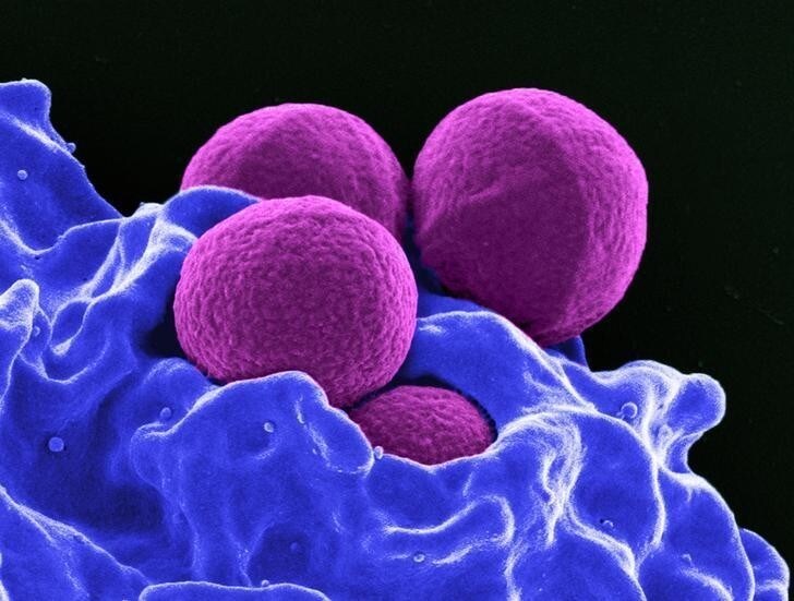 This digitally-colorized scanning electron micrograph depicts four magenta-colored, spherical methicillin-resistant Staphylococcus aureus (MRSA) bacteria in the process of being phagocytized by a blue-colored human white blood cells in this undated handout photo. TO MATCH SPECIAL REPORT USA-UNCOUNTED/SURVEILLANCE National Institute of Allergy and Infectious Diseases (NIAID)/Handout via REUTERS ATTENTION EDITORS - THIS IMAGE WAS PROVIDED BY A THIRD PARTY. EDITORIAL USE ONLYONLY