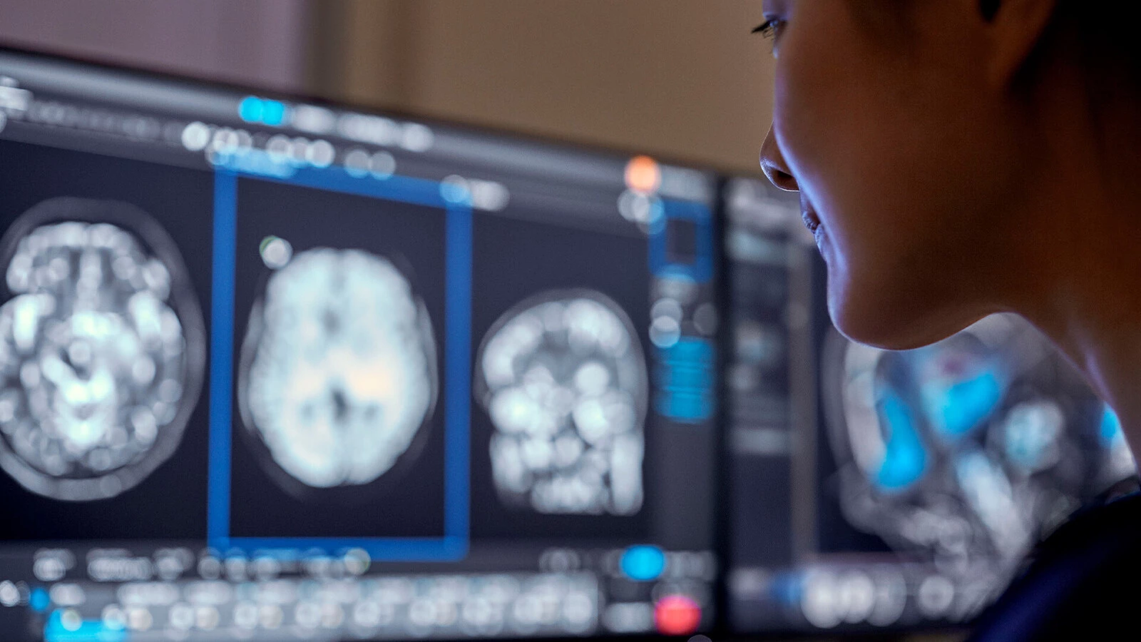 A clinician reviews brain scans on a screen.