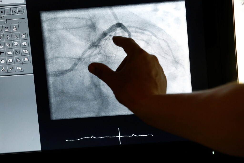 A control monitor being used during a heart catheterization at Heidelberg University Hospital, Germany.