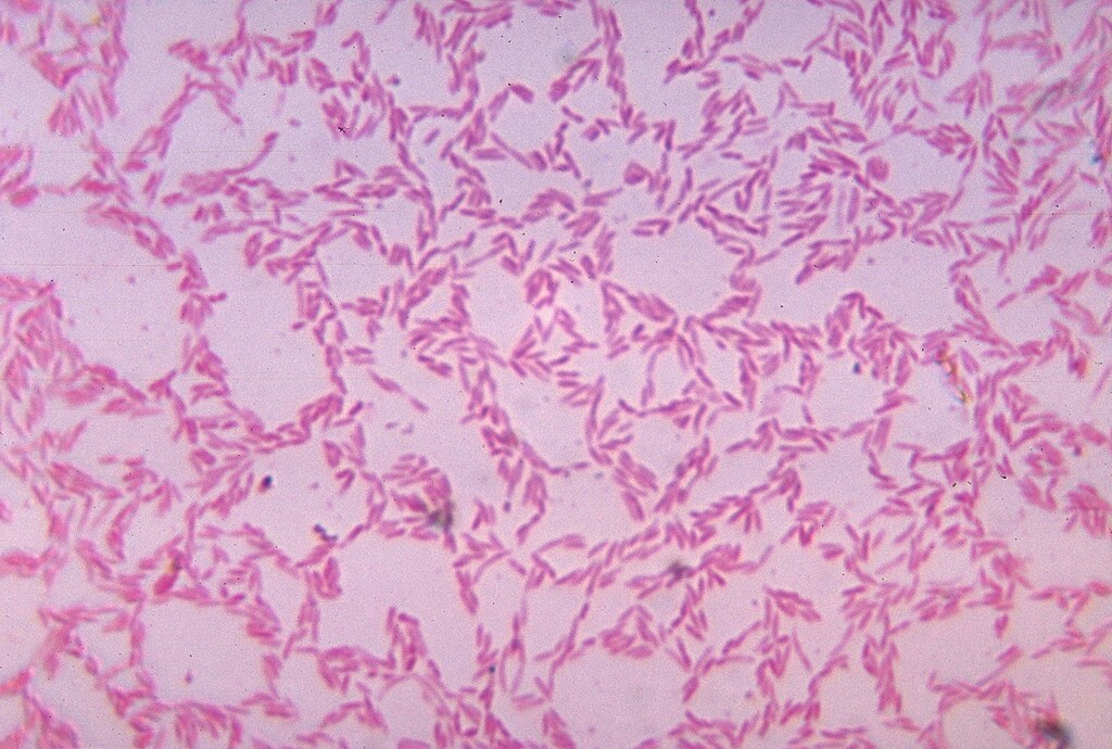 Image: Gut bacteria shown under a microscope