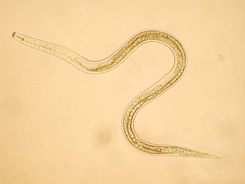 Les vers nématodes n'ont que 302 neurones, contre 80 milliards pour l'être humain, mais nous n'arrivons toujours pas à le simuler... (cc) Scot Nelson