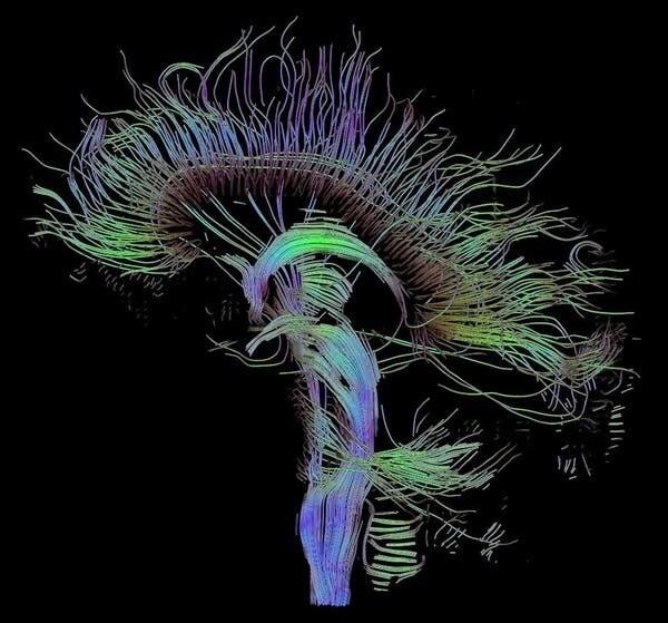 Connections neuronales.