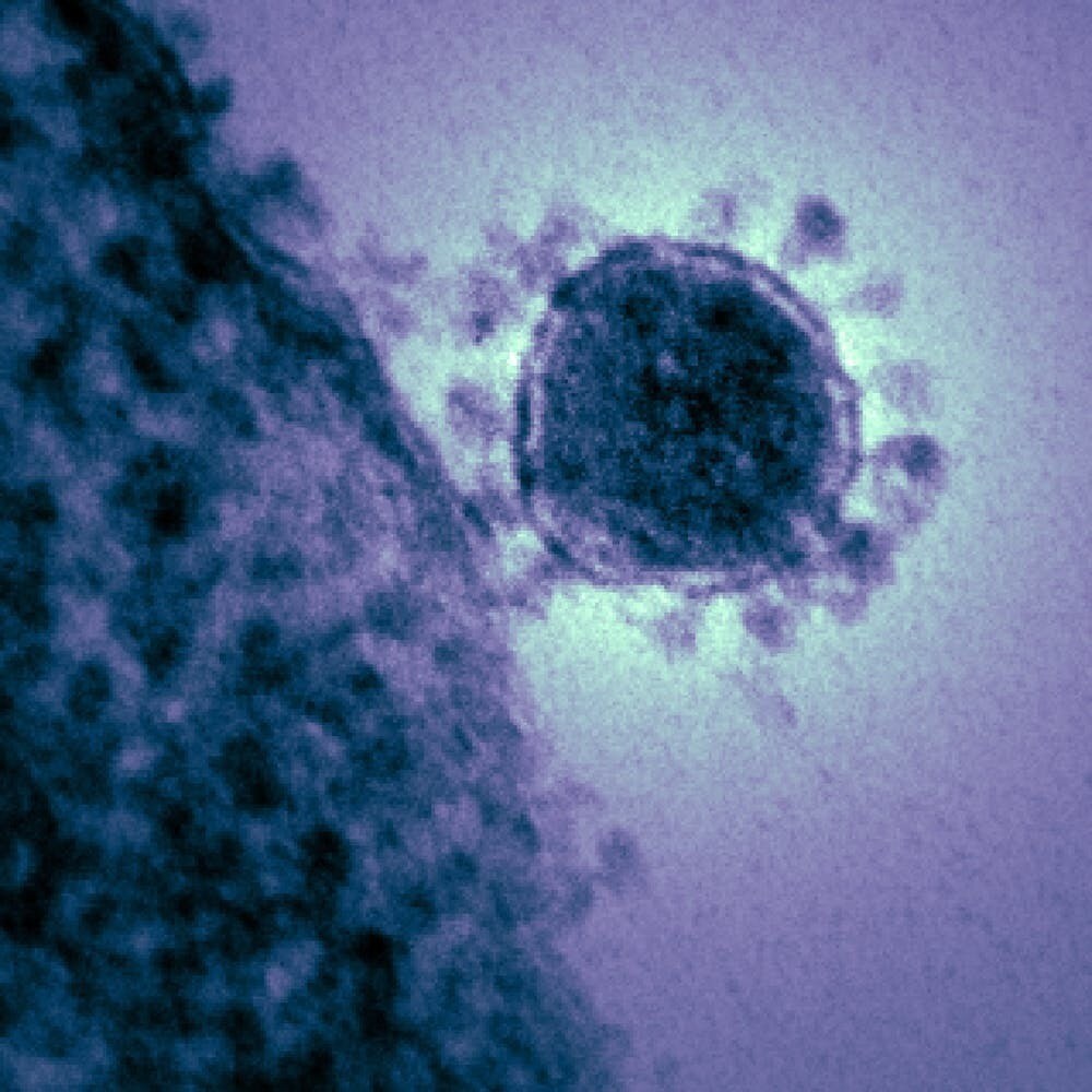 The electron microscopic image, reveals the crown shape structural details for which the coronavirus was named. This image is of the Middle East respiratory syndrome coronavirus (MERS-CoV)