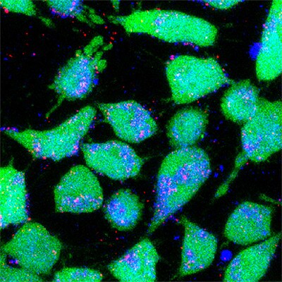 Cancer cells nanoparticles