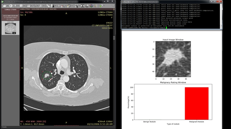  A screenshot of the lung cancer detection software. 