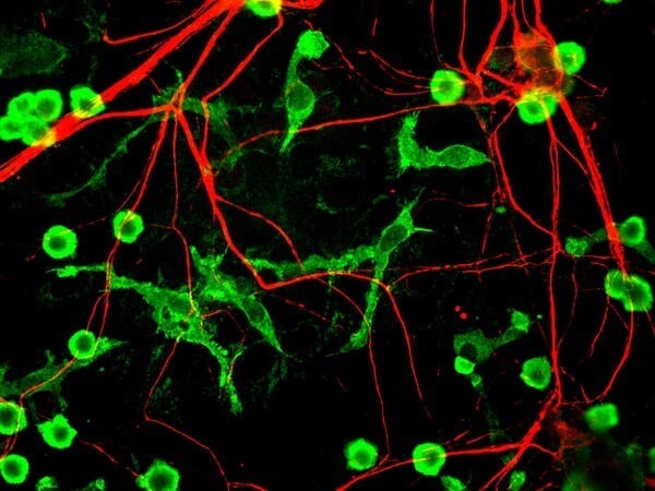 Neurones et microglies.