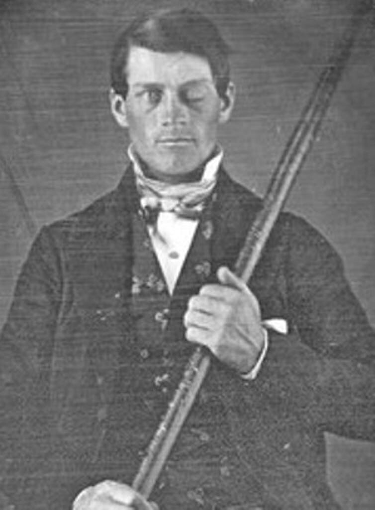 Phineas Gage.